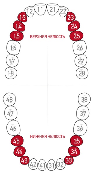 Кламп для коффердама Dentech (Япония) 1АТ